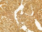 PIK3CA Antibody in Immunohistochemistry (Paraffin) (IHC (P))