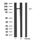 PIK3CA Antibody in Western Blot (WB)