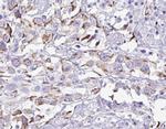 SMAD5 Antibody in Immunocytochemistry (ICC/IF)