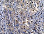 CD122 Antibody in Immunohistochemistry (Paraffin) (IHC (P))