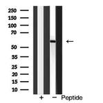 CD122 Antibody in Western Blot (WB)