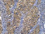 CD103 Antibody in Immunohistochemistry (Paraffin) (IHC (P))