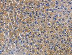 CD103 Antibody in Immunohistochemistry (Paraffin) (IHC (P))