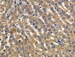 PDGF-A Antibody in Immunohistochemistry (Paraffin) (IHC (P))