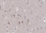 BMP-6 Antibody in Immunohistochemistry (Paraffin) (IHC (P))