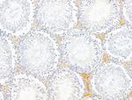 Claudin 6 Antibody in Immunohistochemistry (Paraffin) (IHC (P))