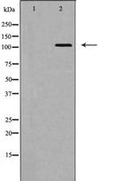 EphA5 Antibody in Western Blot (WB)