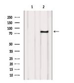 FSHR Antibody in Western Blot (WB)