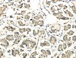 EphA3 Antibody in Immunohistochemistry (Paraffin) (IHC (P))