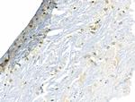 NOTCH2 (Cleaved Ala1734) Antibody in Immunohistochemistry (Paraffin) (IHC (P))