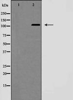 NOTCH2 (Cleaved Ala1734) Antibody in Western Blot (WB)