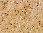 RBMX Antibody in Immunohistochemistry (Paraffin) (IHC (P))