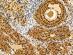 RBMX Antibody in Immunohistochemistry (Paraffin) (IHC (P))