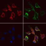 KEAP1 Antibody in Immunocytochemistry (ICC/IF)