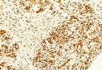 KEAP1 Antibody in Immunohistochemistry (Paraffin) (IHC (P))