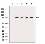 KEAP1 Antibody in Western Blot (WB)