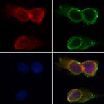 hnRNP A1 Antibody in Immunocytochemistry (ICC/IF)