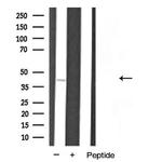 hnRNP A1 Antibody in Western Blot (WB)