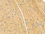 EphB4 Antibody in Immunohistochemistry (Paraffin) (IHC (P))