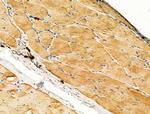 EphB4 Antibody in Immunohistochemistry (Paraffin) (IHC (P))