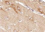 EphB4 Antibody in Immunohistochemistry (Paraffin) (IHC (P))