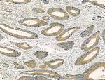 Kir6.2 (KCNJ11) Antibody in Immunohistochemistry (Paraffin) (IHC (P))