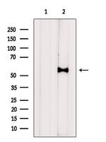 Kir6.2 (KCNJ11) Antibody in Western Blot (WB)