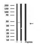 Kir6.2 (KCNJ11) Antibody in Western Blot (WB)