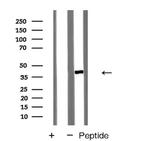 CMKLR1 Antibody in Western Blot (WB)