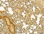 MKL1 Antibody in Immunohistochemistry (Paraffin) (IHC (P))