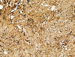 MKL1 Antibody in Immunohistochemistry (Paraffin) (IHC (P))