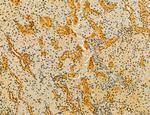 MKL1 Antibody in Immunohistochemistry (Paraffin) (IHC (P))