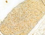 MKL1 Antibody in Immunohistochemistry (Paraffin) (IHC (P))