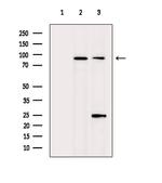 MKL1 Antibody in Western Blot (WB)