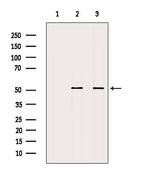 MKL1 Antibody in Western Blot (WB)