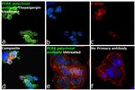 PERK Antibody in Immunocytochemistry (ICC/IF)