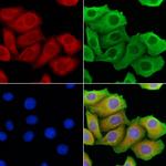 PERK Antibody in Immunocytochemistry (ICC/IF)