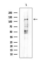 PERK Antibody in Western Blot (WB)