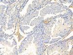 KChIP3 Antibody in Immunohistochemistry (Paraffin) (IHC (P))