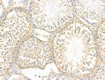 KChIP3 Antibody in Immunohistochemistry (Paraffin) (IHC (P))