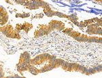 KChIP3 Antibody in Immunohistochemistry (Paraffin) (IHC (P))