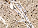 PIASy Antibody in Immunohistochemistry (Paraffin) (IHC (P))