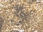 PIASy Antibody in Immunohistochemistry (Paraffin) (IHC (P))