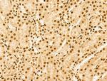 PIASy Antibody in Immunohistochemistry (Paraffin) (IHC (P))