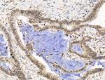 PIASy Antibody in Immunohistochemistry (Paraffin) (IHC (P))