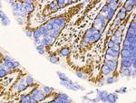 PIASy Antibody in Immunohistochemistry (Paraffin) (IHC (P))