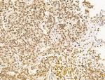 PIASy Antibody in Immunohistochemistry (Paraffin) (IHC (P))