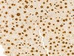 PIASy Antibody in Immunohistochemistry (Paraffin) (IHC (P))