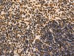 PIASy Antibody in Immunohistochemistry (Paraffin) (IHC (P))