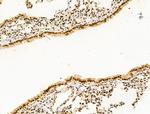 PIASy Antibody in Immunohistochemistry (Paraffin) (IHC (P))